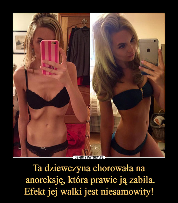 Ta dziewczyna chorowała na anoreksję, która prawie ją zabiła.Efekt jej walki jest niesamowity! –  