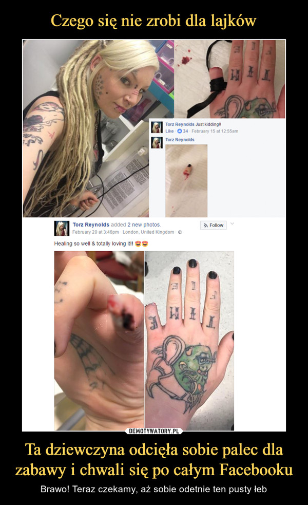 Czego się nie zrobi dla lajków Ta dziewczyna odcięła sobie palec dla zabawy i chwali się po całym Facebooku