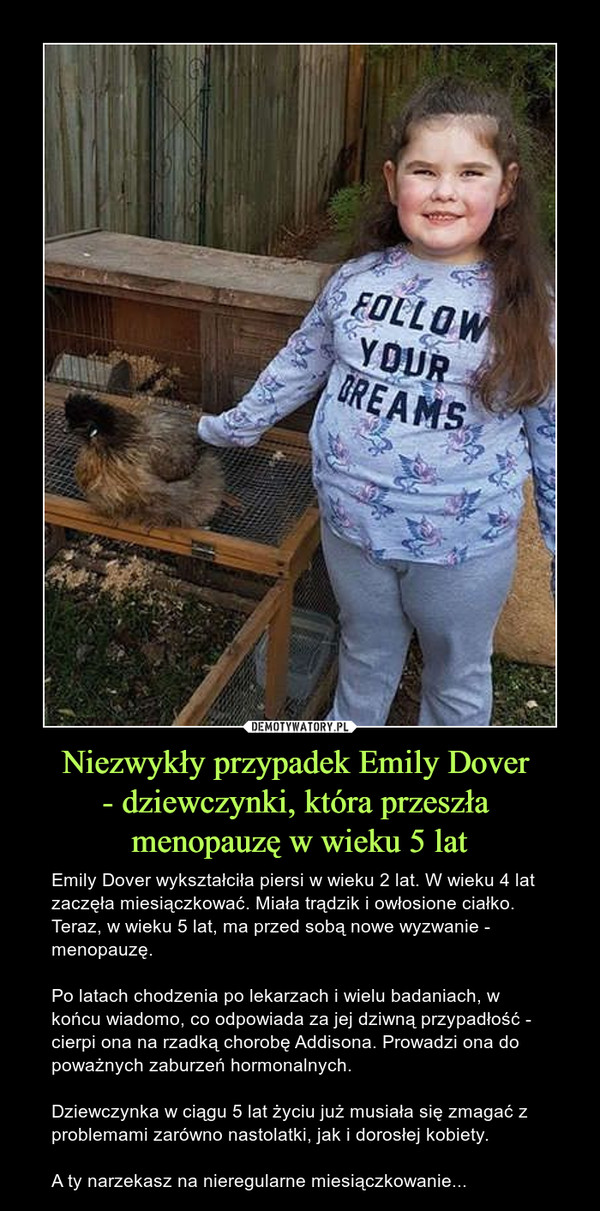 Niezwykły przypadek Emily Dover 
- dziewczynki, która przeszła 
menopauzę w wieku 5 lat