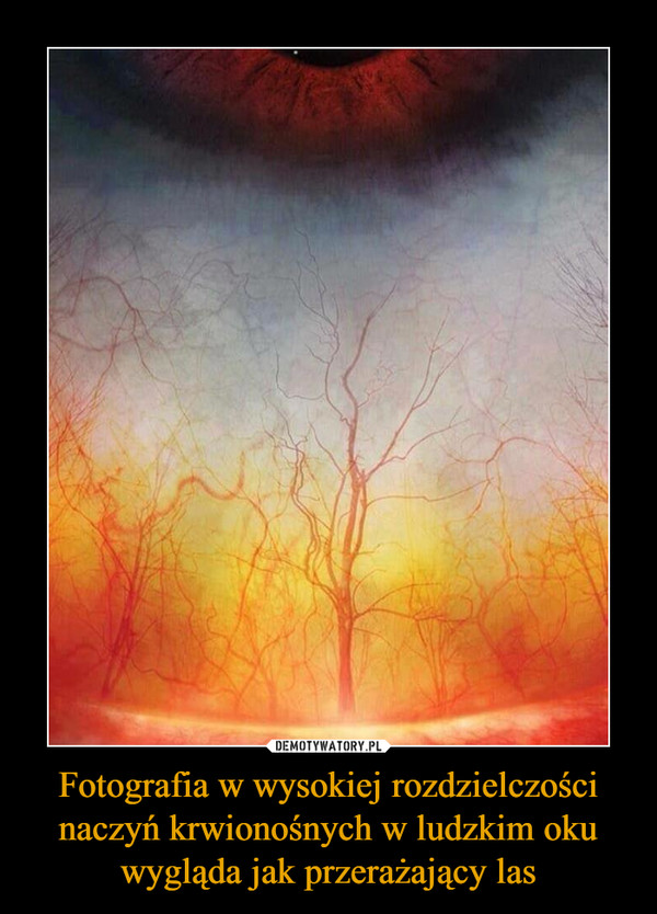 Fotografia w wysokiej rozdzielczości naczyń krwionośnych w ludzkim oku wygląda jak przerażający las –  