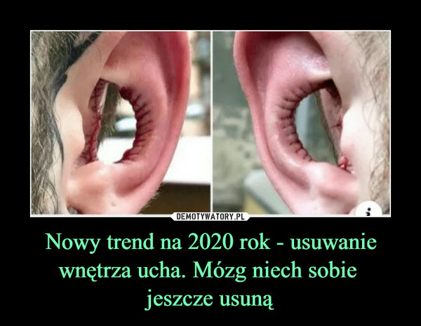 Nowy trend na 2020 rok - usuwanie wnętrza ucha. Mózg niech sobie jeszcze usuną –  