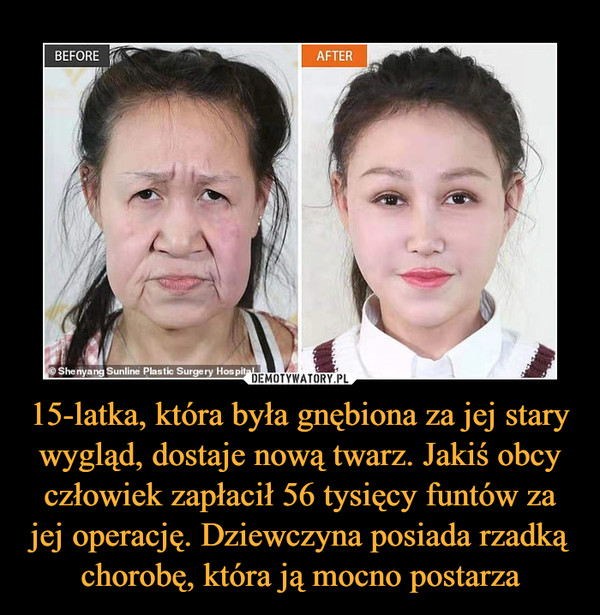 15-latka, która była gnębiona za jej stary wygląd, dostaje nową twarz. Jakiś obcy człowiek zapłacił 56 tysięcy funtów za jej operację. Dziewczyna posiada rzadką chorobę, która ją mocno postarza