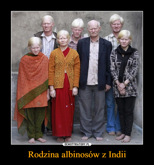 Rodzina albinosów z Indii –  