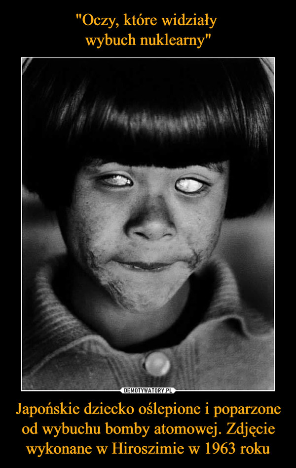 Japońskie dziecko oślepione i poparzone od wybuchu bomby atomowej. Zdjęcie wykonane w Hiroszimie w 1963 roku –  