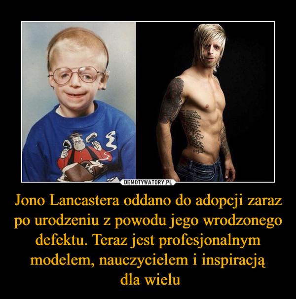 Jono Lancastera oddano do adopcji zaraz po urodzeniu z powodu jego wrodzonego defektu. Teraz jest profesjonalnym modelem, nauczycielem i inspiracją
 dla wielu