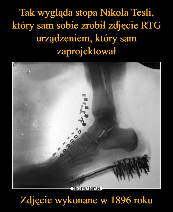 Tak wygląda stopa Nikola Tesli, który sam sobie zrobił zdjęcie RTG urządzeniem, który sam zaprojektował Zdjęcie wykonane w 1896 roku